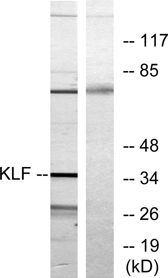 EKLF/CKLF/UKLF Rabbit Polyclonal Antibody