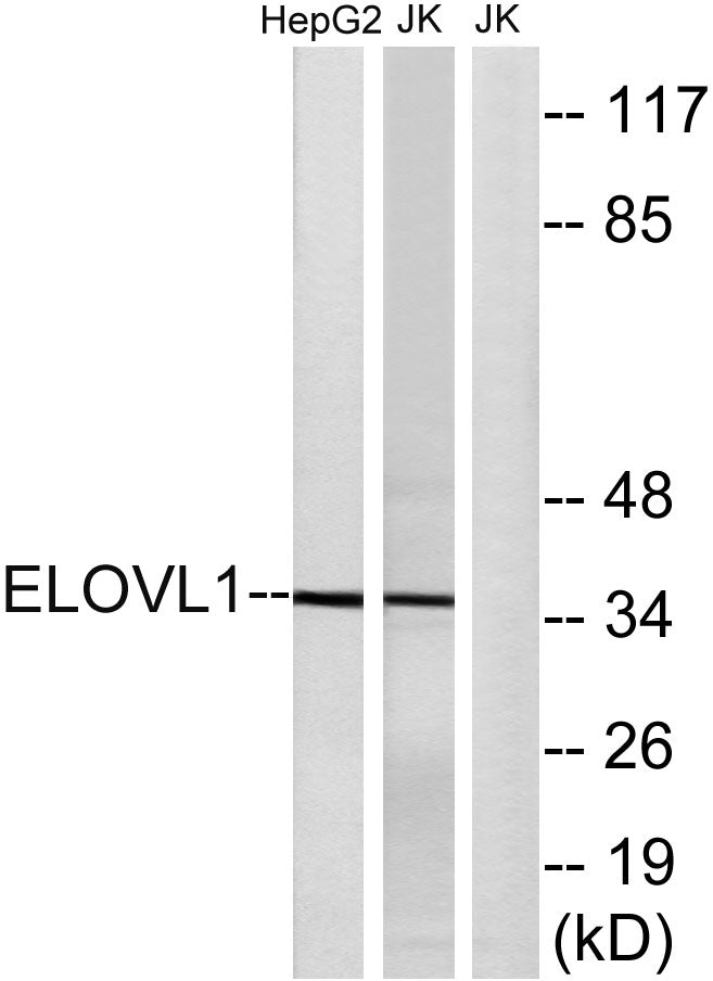 ELOVL1 Rabbit Polyclonal Antibody