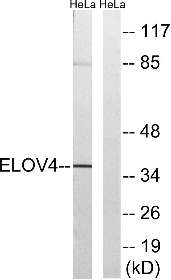 ELOVL4 Rabbit Polyclonal Antibody