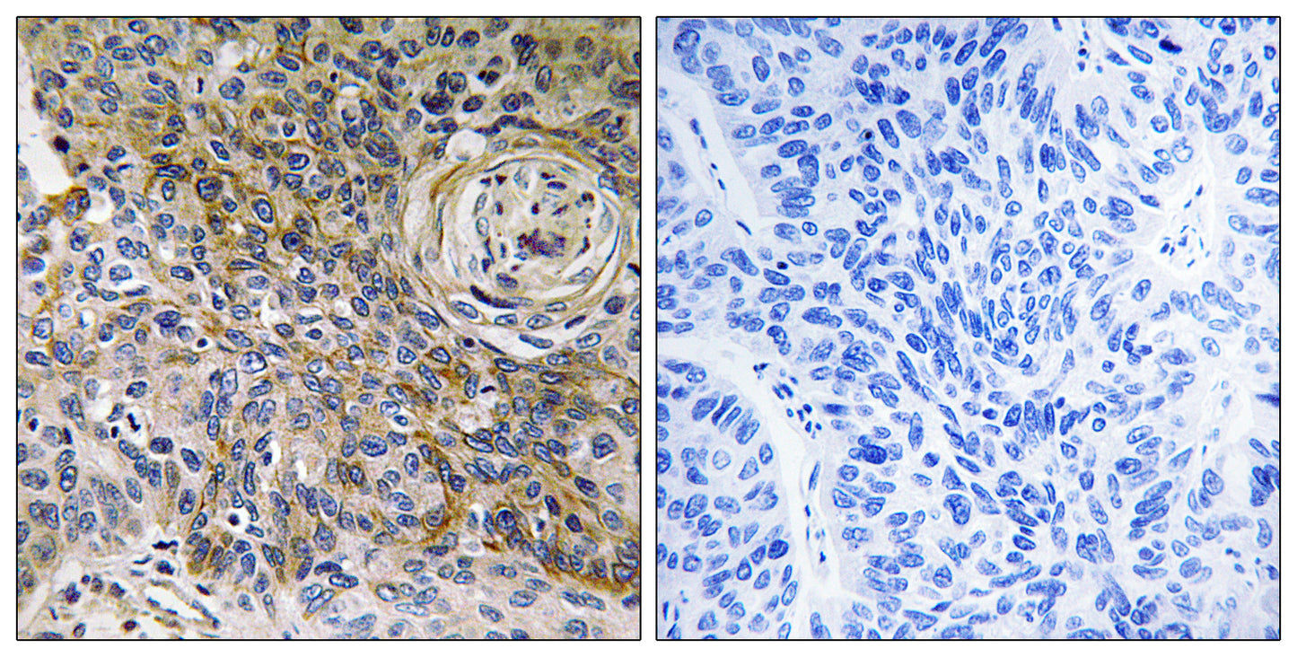 EMMPRIN Rabbit Polyclonal Antibody