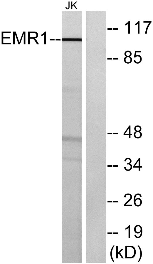 EMR1 Rabbit Polyclonal Antibody