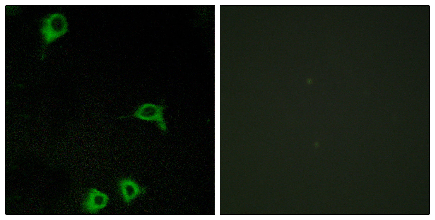 EMR2 Rabbit Polyclonal Antibody