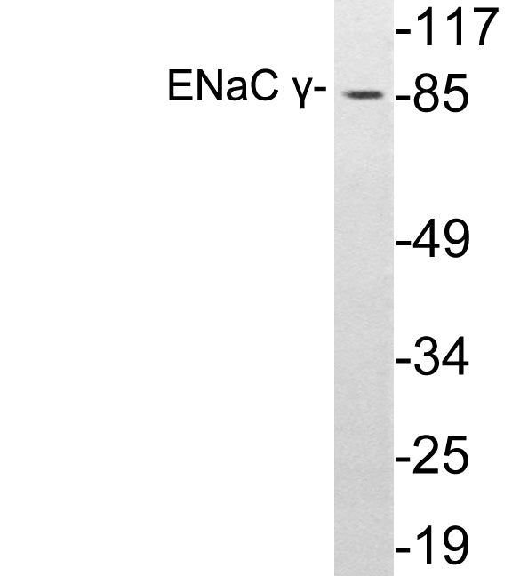ENaC γ Rabbit Polyclonal Antibody