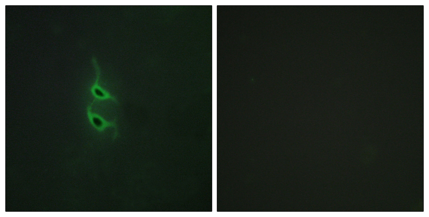 Endo180 Rabbit Polyclonal Antibody
