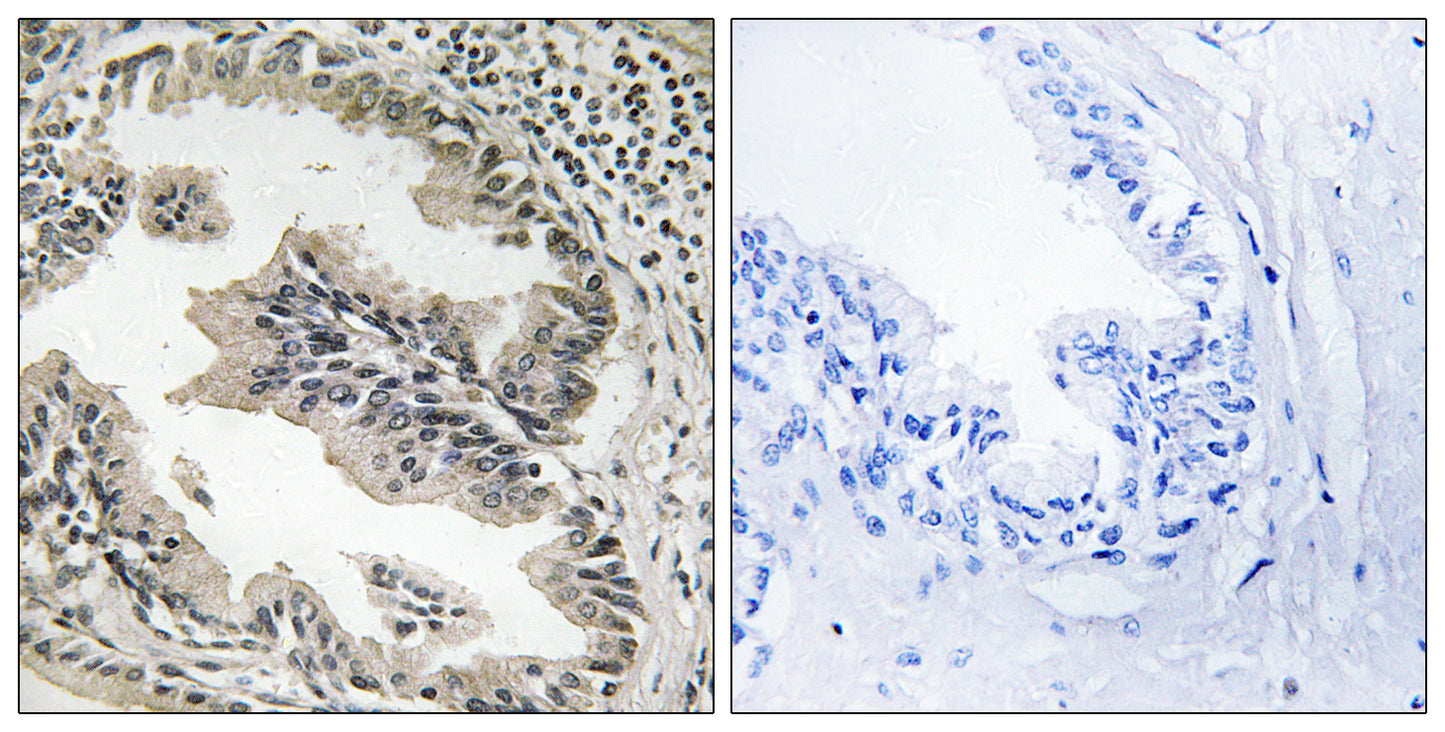 Endophilin B2 Rabbit Polyclonal Antibody