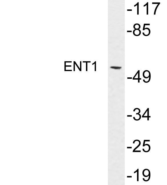 ENT1 Rabbit Polyclonal Antibody