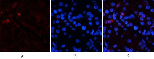 EPAS-1 Rabbit Polyclonal Antibody