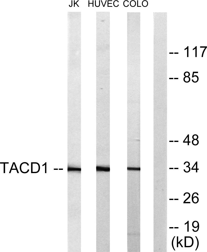 EP-CAM Rabbit Polyclonal Antibody