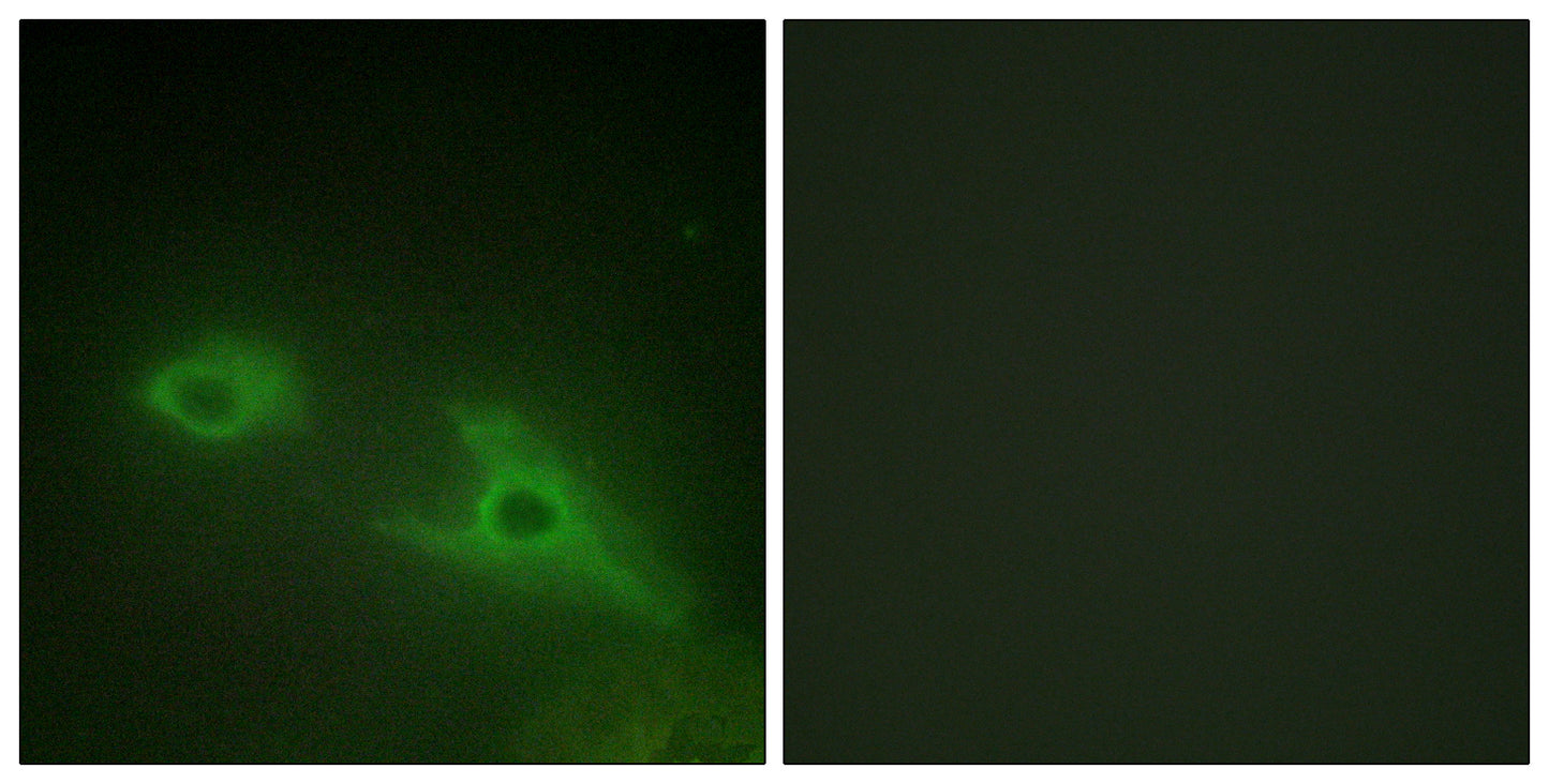 EphA1 Rabbit Polyclonal Antibody