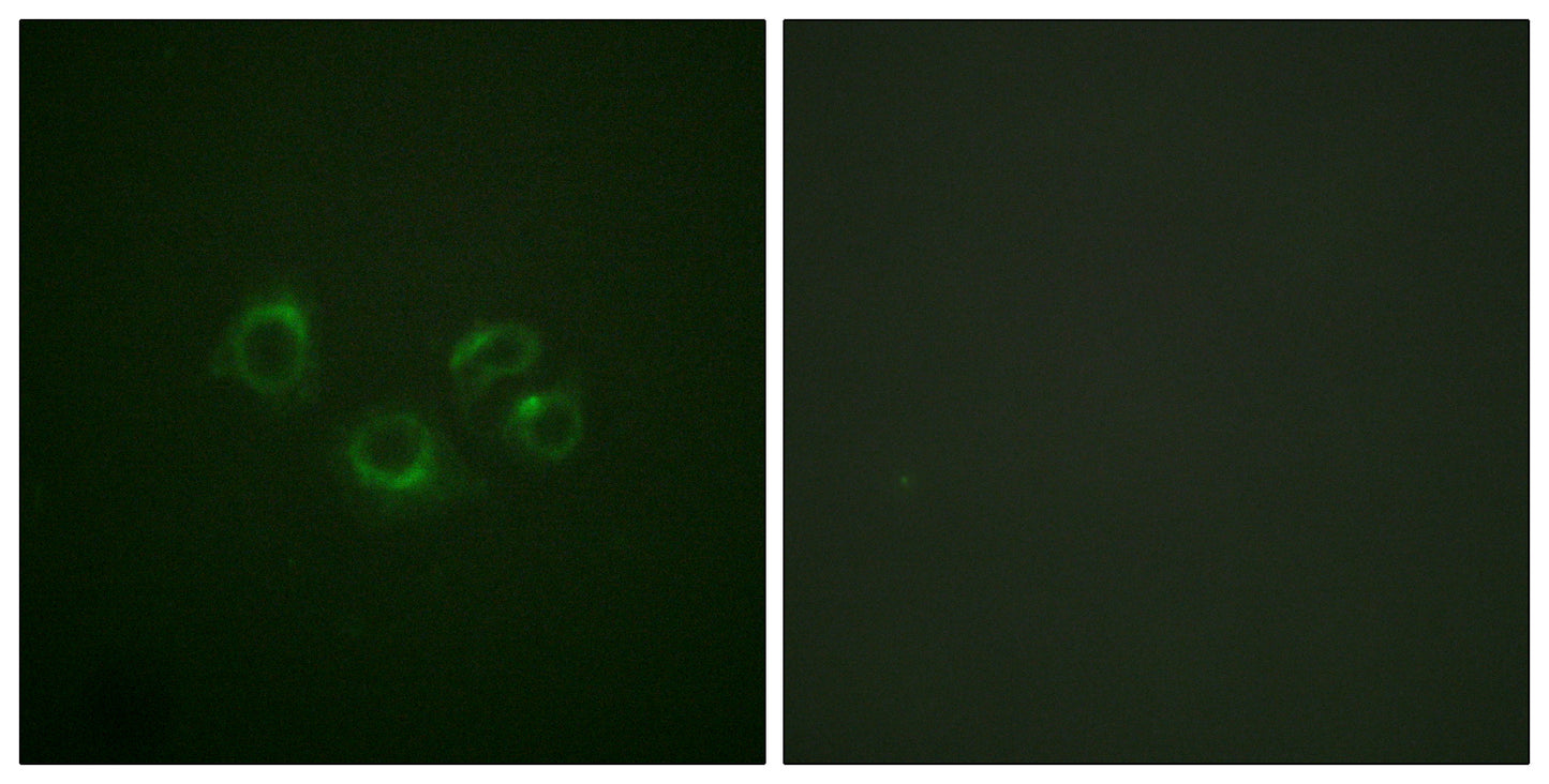 EphA2/3/4 Rabbit Polyclonal Antibody