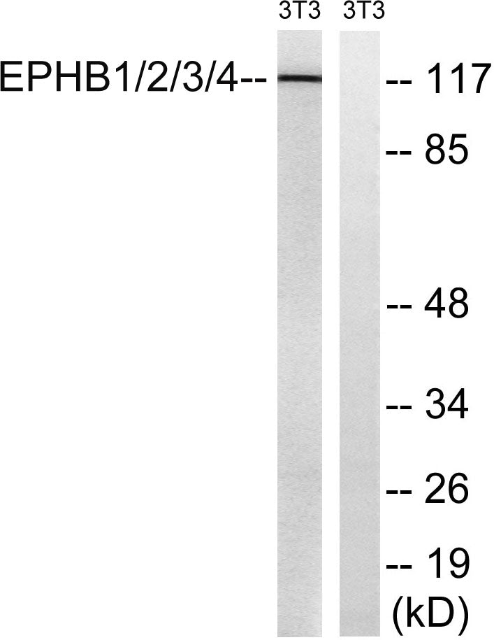 EphB1/2/3/4 Rabbit Polyclonal Antibody
