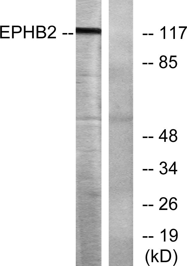EphB2 Rabbit Polyclonal Antibody