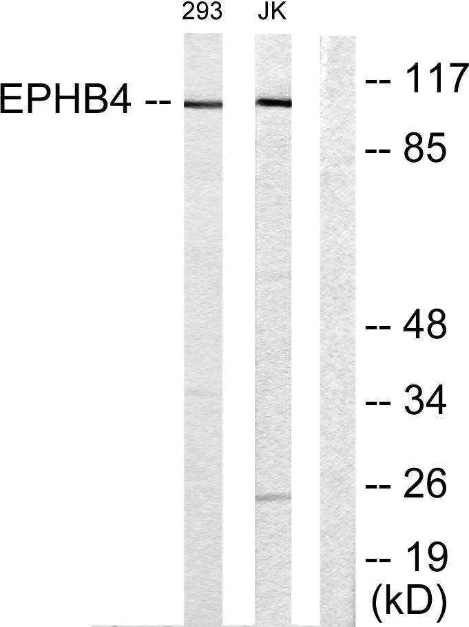 EphB4 Rabbit Polyclonal Antibody