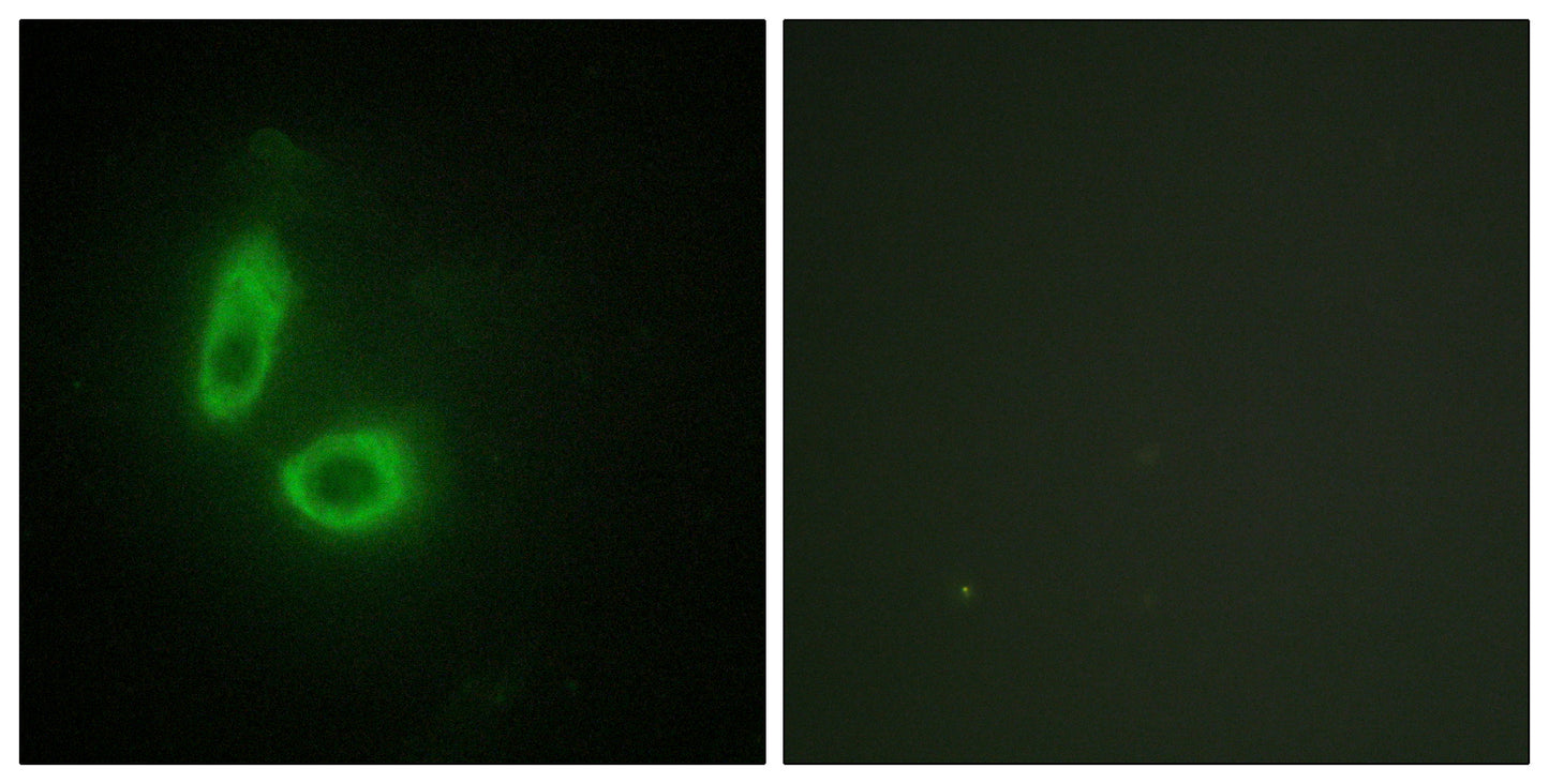 Ephrin-A1 Rabbit Polyclonal Antibody