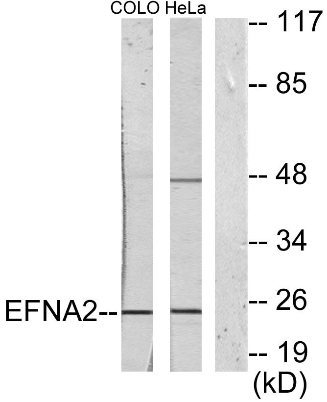 Ephrin-A2 Rabbit Polyclonal Antibody