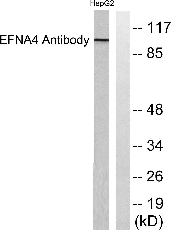Ephrin-A4 Rabbit Polyclonal Antibody