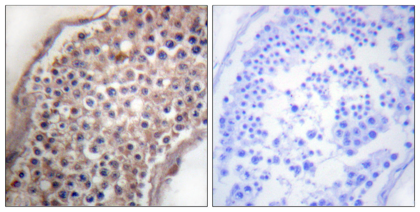 Ephrin-B1/2 Rabbit Polyclonal Antibody