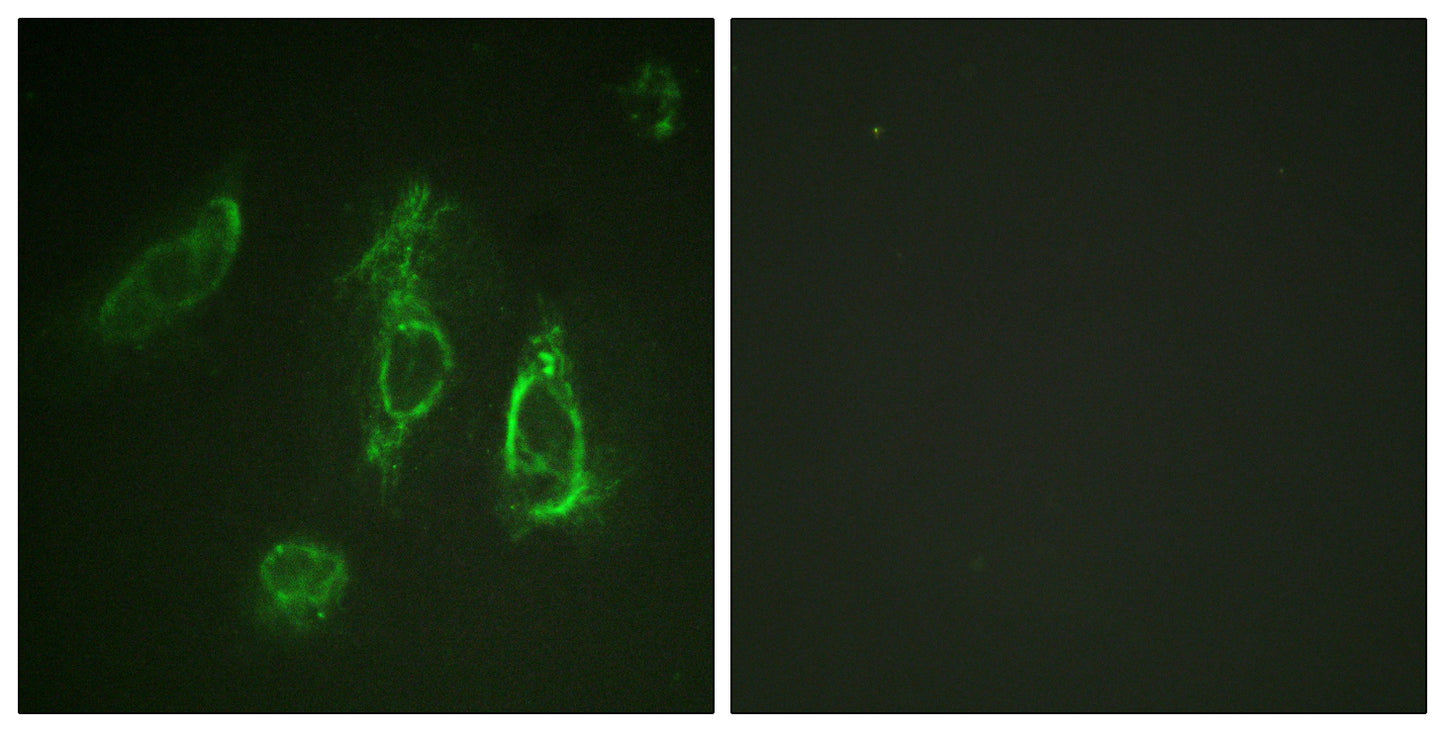 EpoR Rabbit Polyclonal Antibody