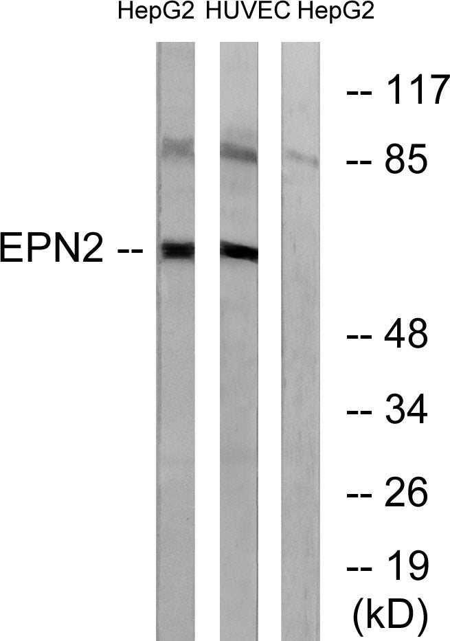 Epsin 2 Rabbit Polyclonal Antibody