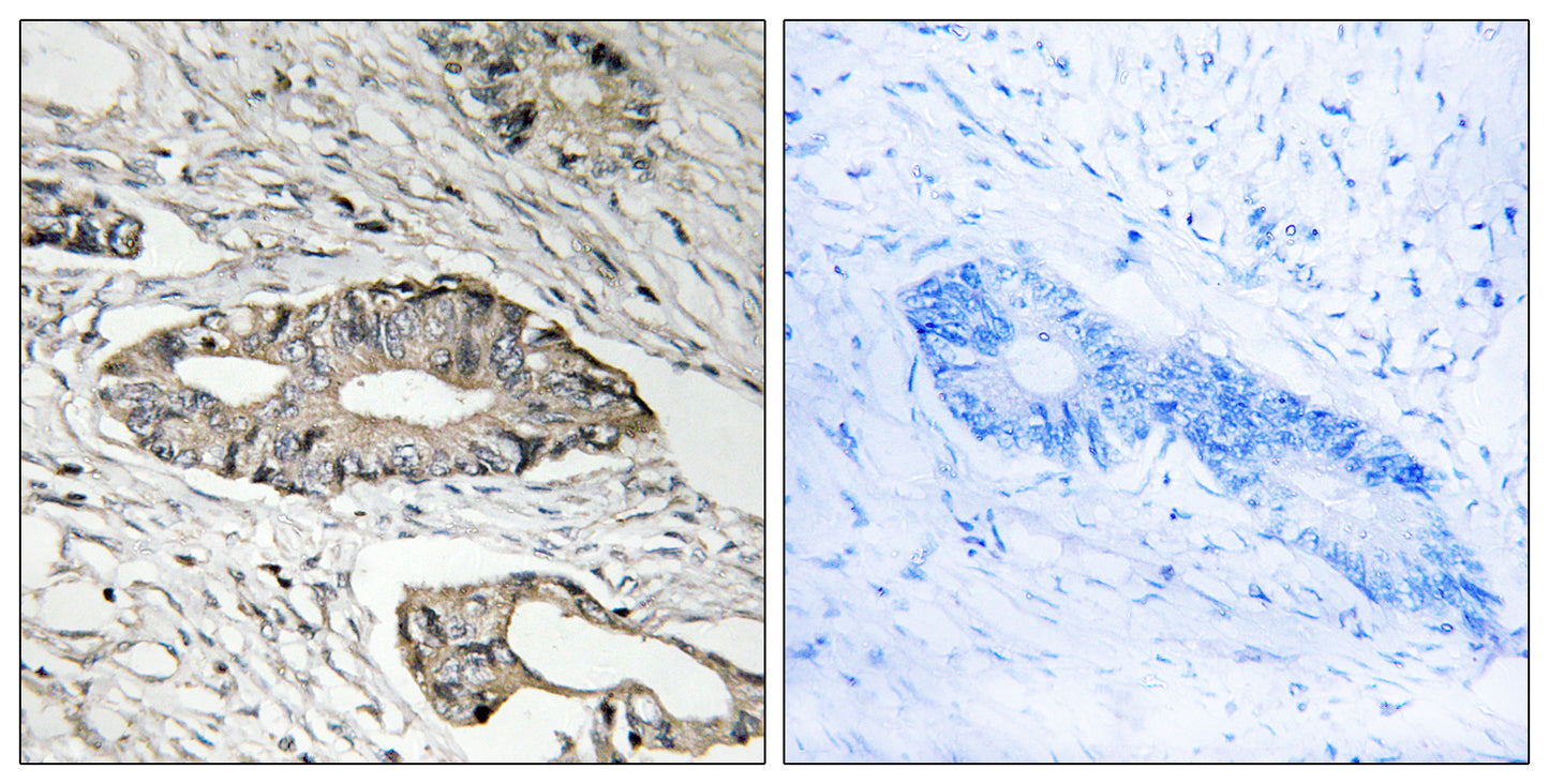 Epsin 3 Rabbit Polyclonal Antibody