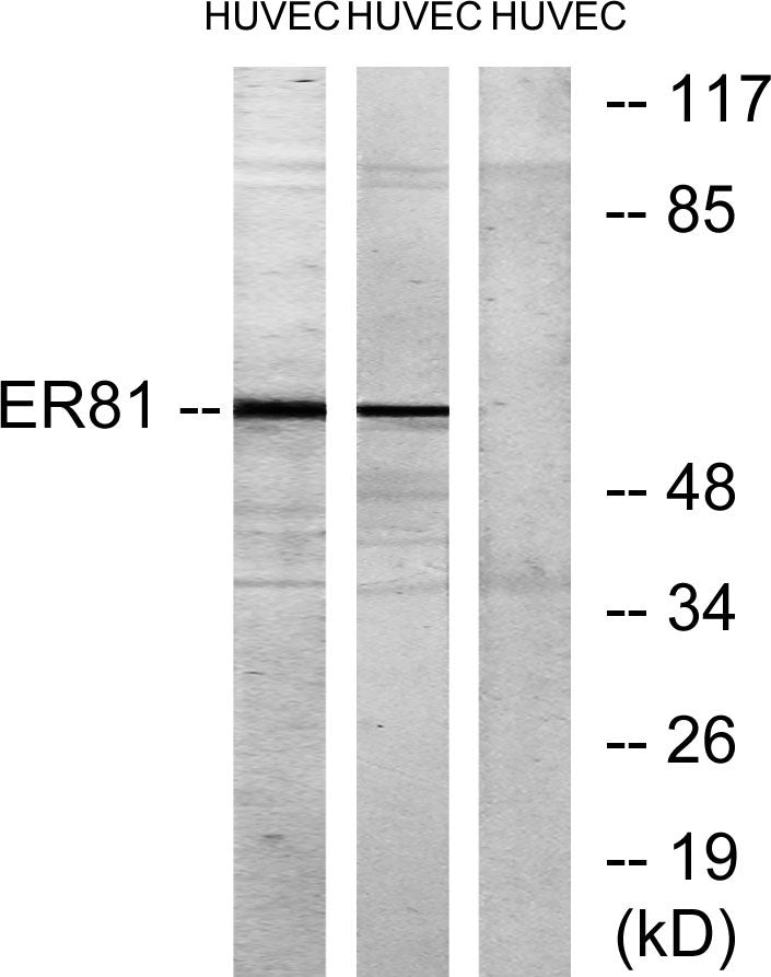 ER81 Rabbit Polyclonal Antibody