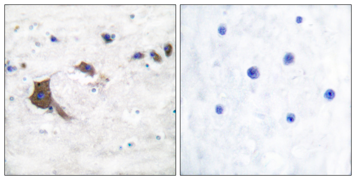 ERAB Rabbit Polyclonal Antibody
