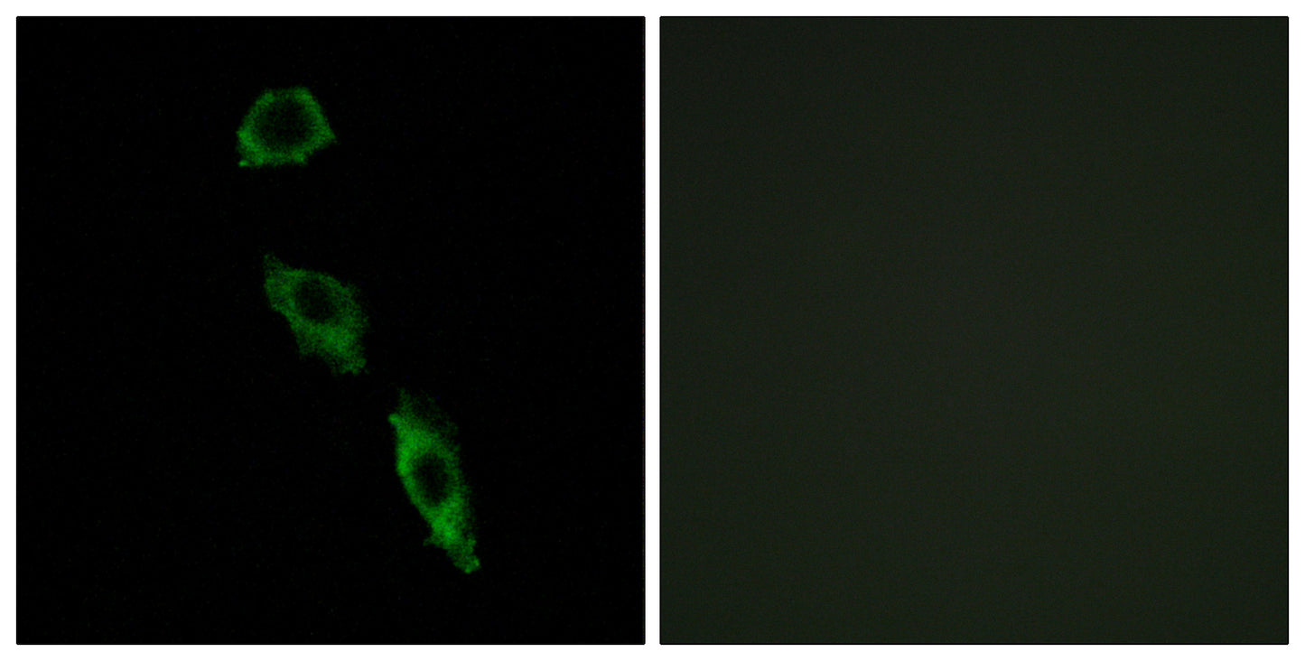 E-Ras Rabbit Polyclonal Antibody