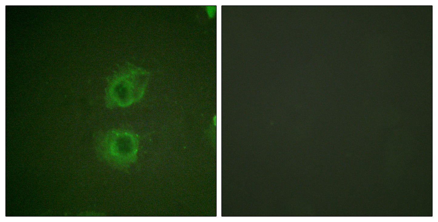 ErbB-3 Rabbit Polyclonal Antibody