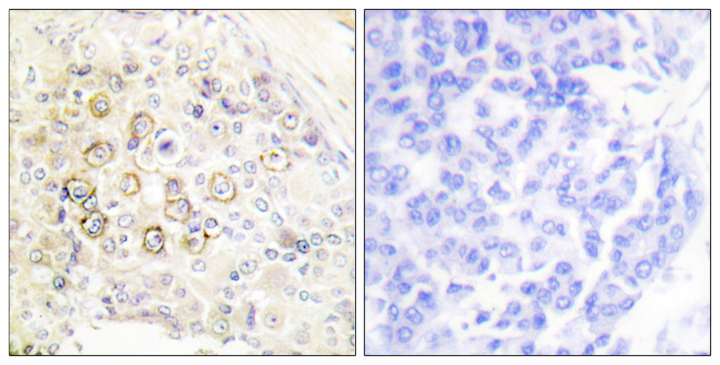 ErbB-3 Rabbit Polyclonal Antibody