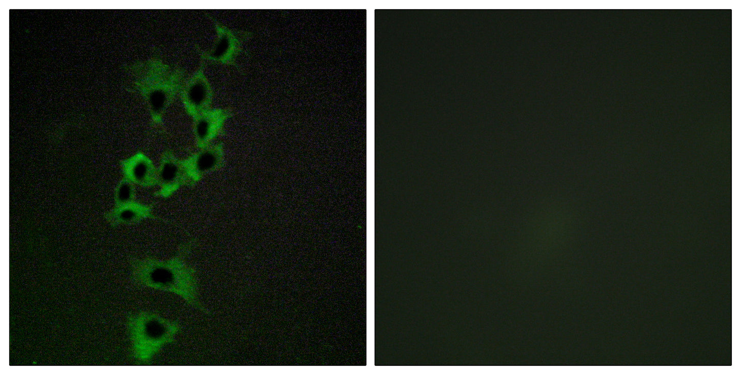 ErbB-4 Rabbit Polyclonal Antibody