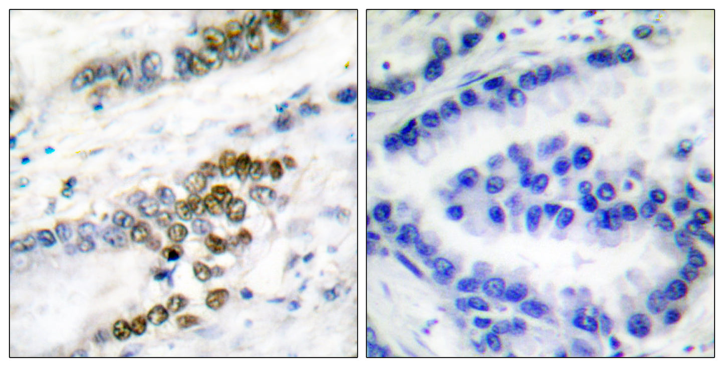 ERCC1 Rabbit Polyclonal Antibody
