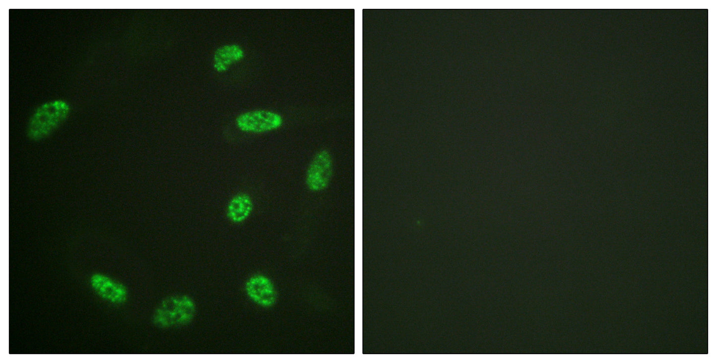 ERF Rabbit Polyclonal Antibody