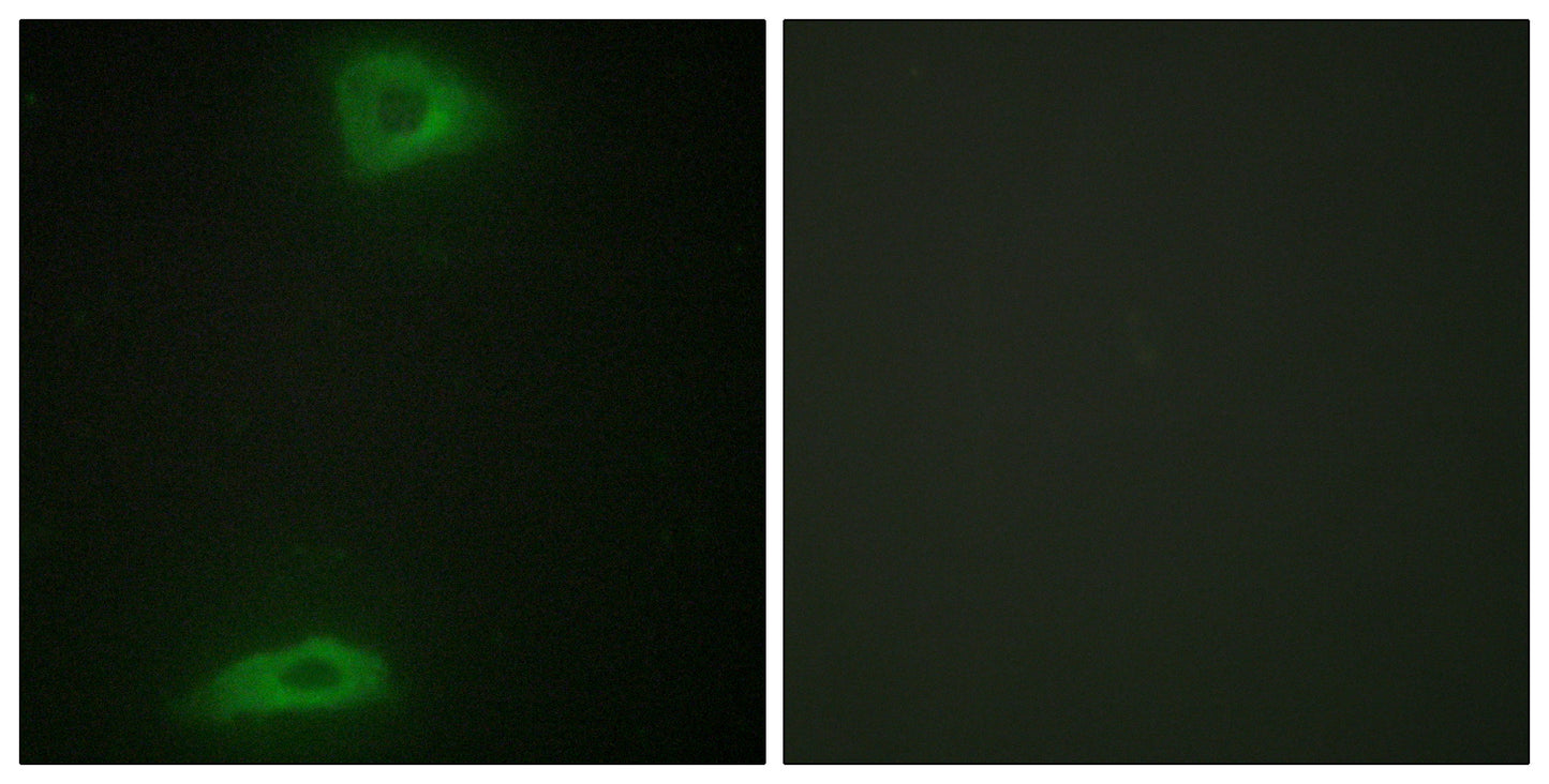 ERGIC-3 Rabbit Polyclonal Antibody