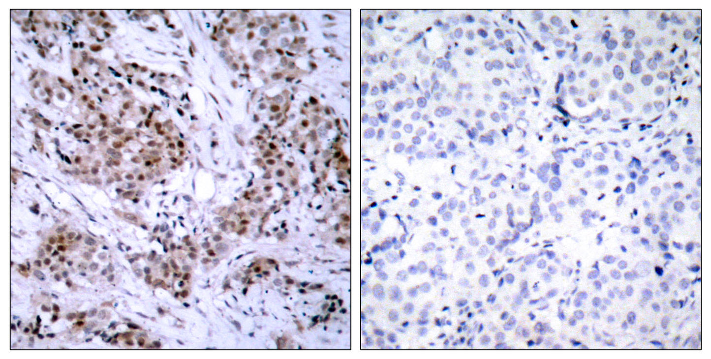ERα Rabbit Polyclonal Antibody