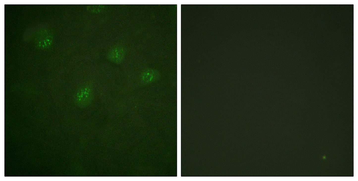 ERα Rabbit Polyclonal Antibody