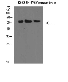 E-Selectin Rabbit Polyclonal Antibody