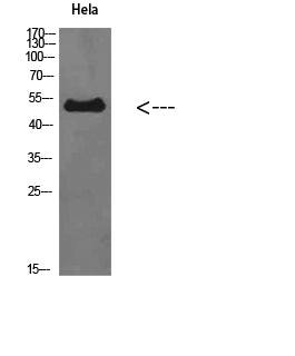 ETBR Rabbit Polyclonal Antibody