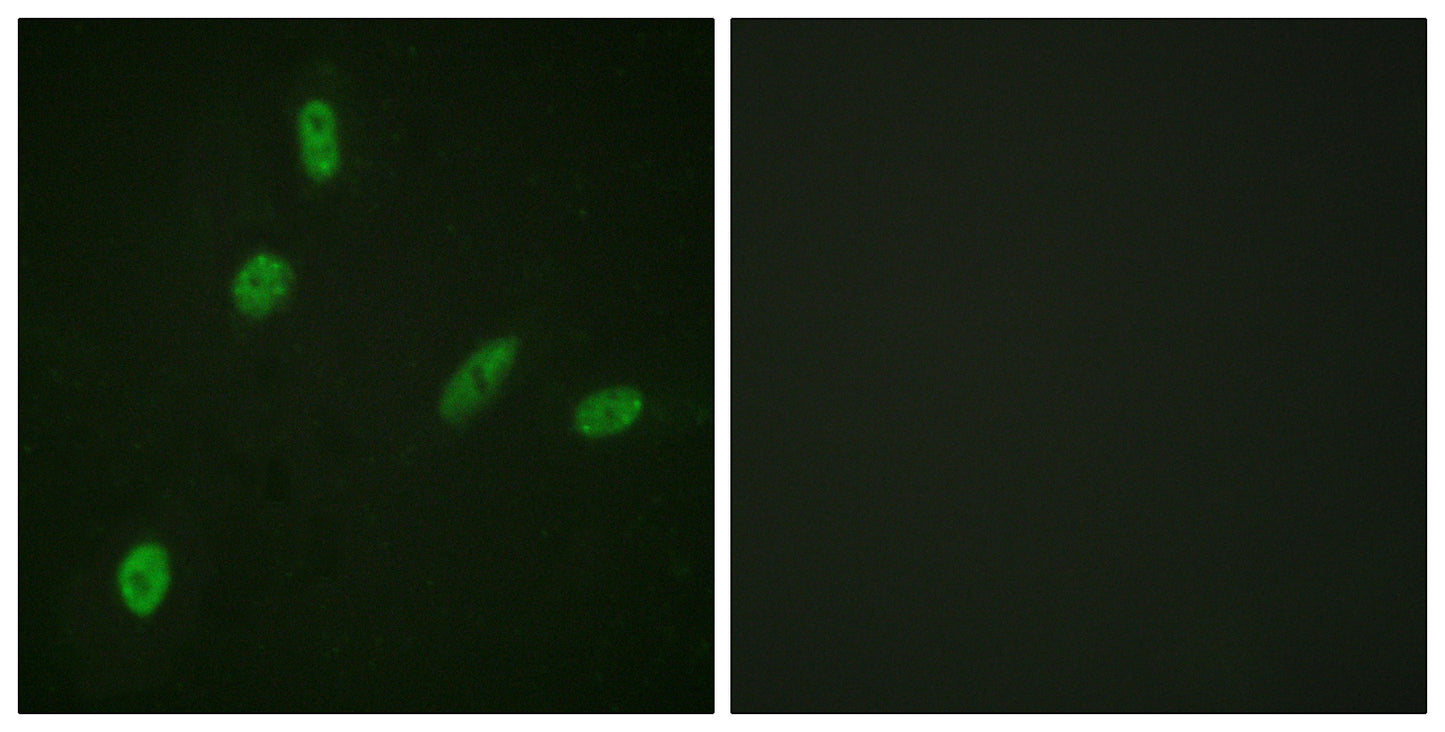 ETS1 Rabbit Polyclonal Antibody