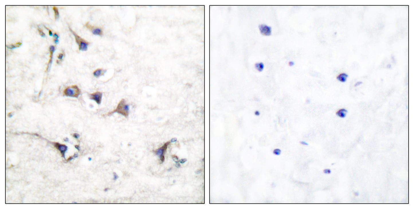Ezrin Rabbit Polyclonal Antibody