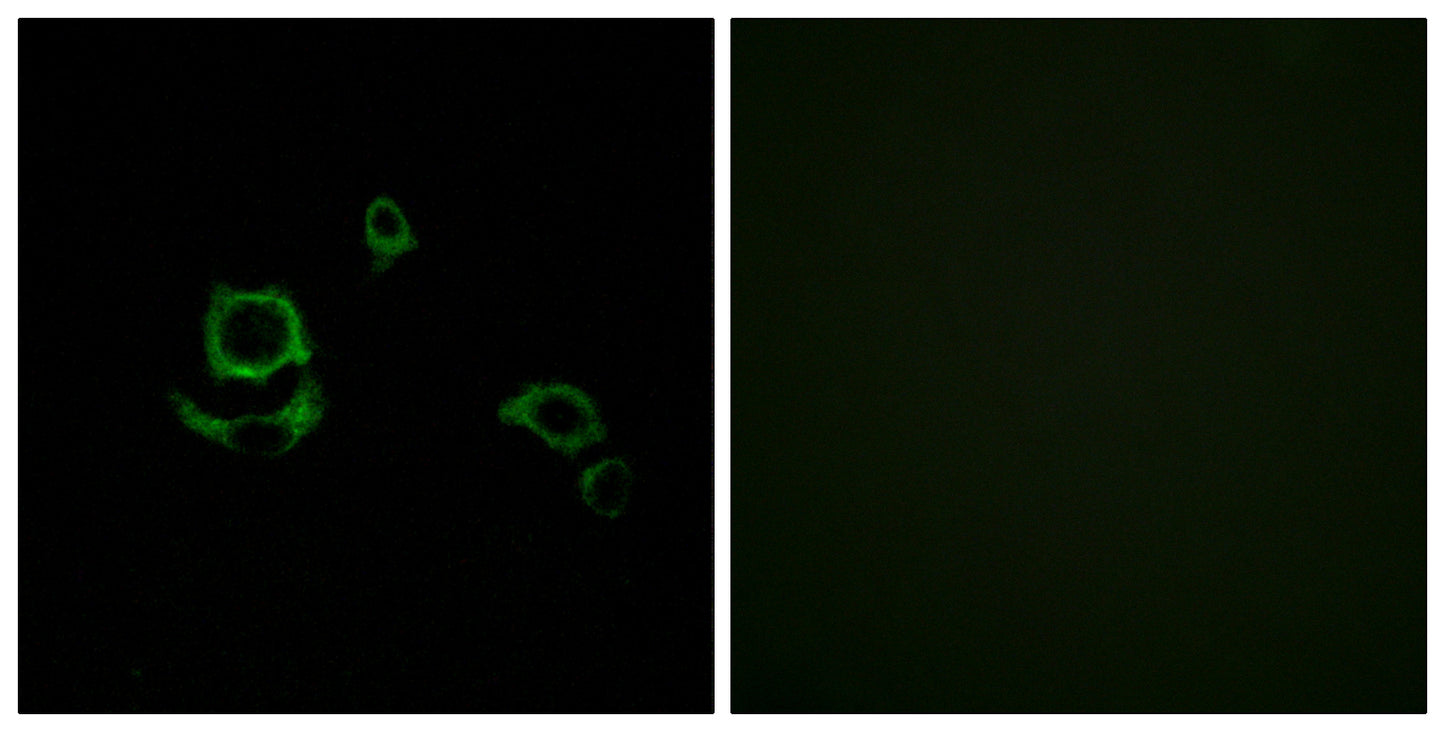 Factor XIII B Rabbit Polyclonal Antibody