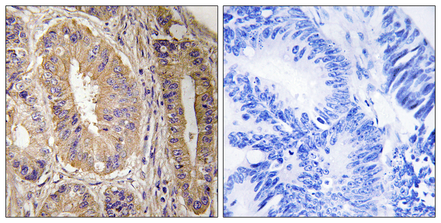 FAK Rabbit Polyclonal Antibody
