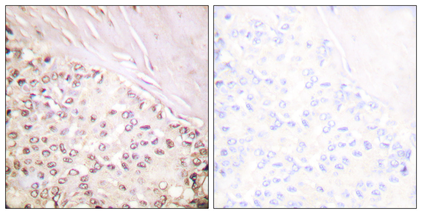FANCD2 Rabbit Polyclonal Antibody