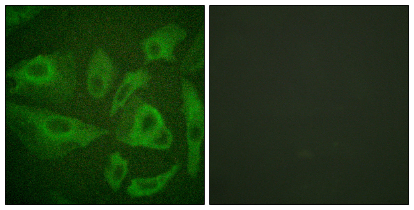 FAS Rabbit Polyclonal Antibody