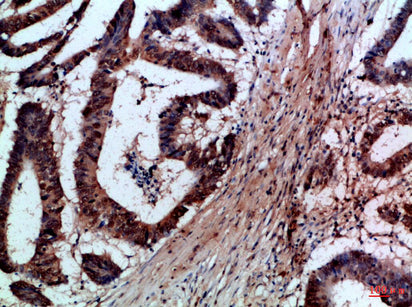 FAS-L Rabbit Polyclonal Antibody