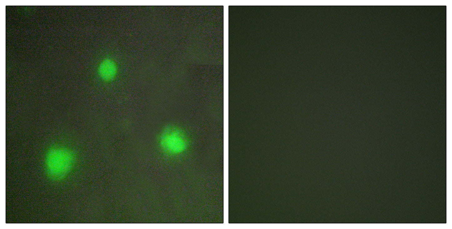 FAST-1/2 Rabbit Polyclonal Antibody