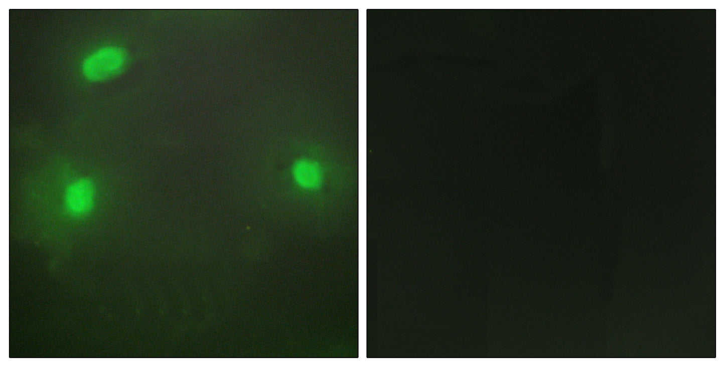 FEN-1 Rabbit Polyclonal Antibody