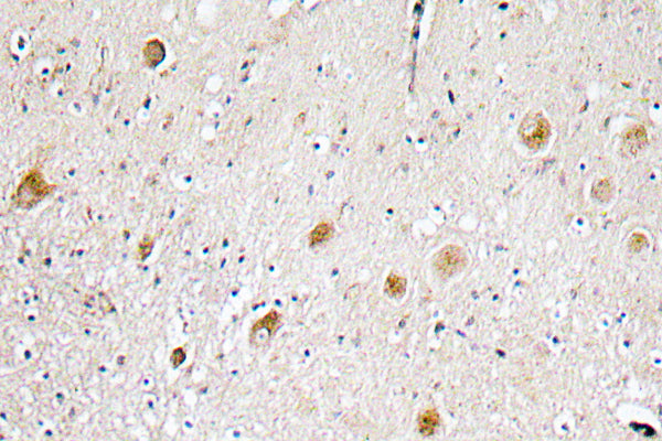 FGF-1 Rabbit Polyclonal Antibody