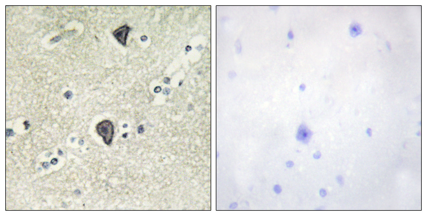 FGFR-3 Rabbit Polyclonal Antibody