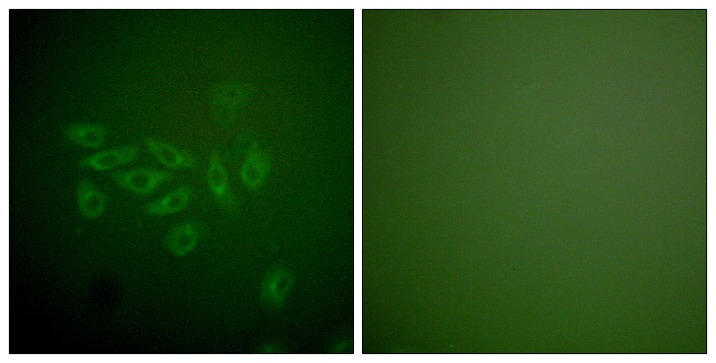 Fhit Rabbit Polyclonal Antibody