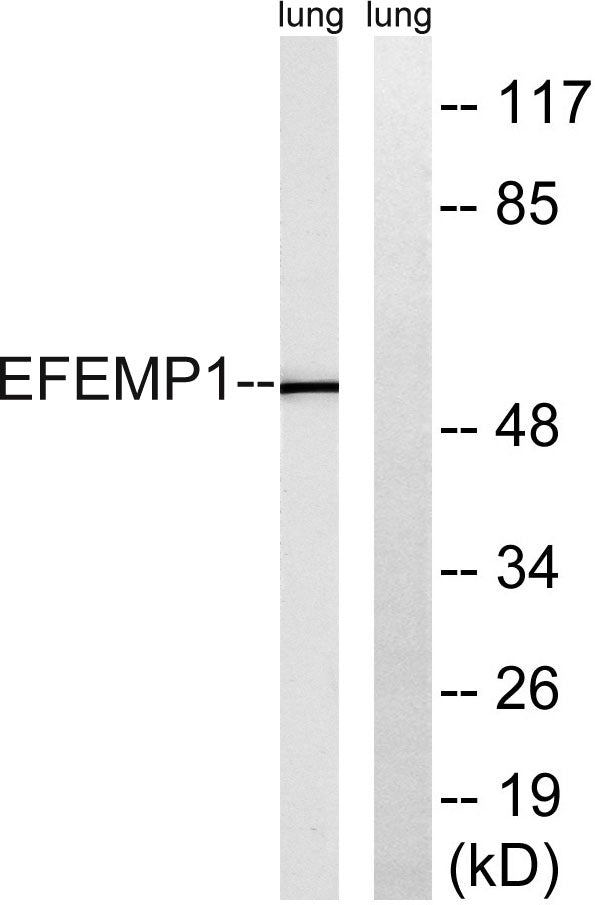 Fibulin-3 Rabbit Polyclonal Antibody